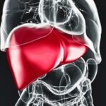 The Information About Alcohol Related Liver Disease (ARLD)